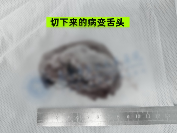 ����������఩���������ҽ��Ϊ������һ������ͷ