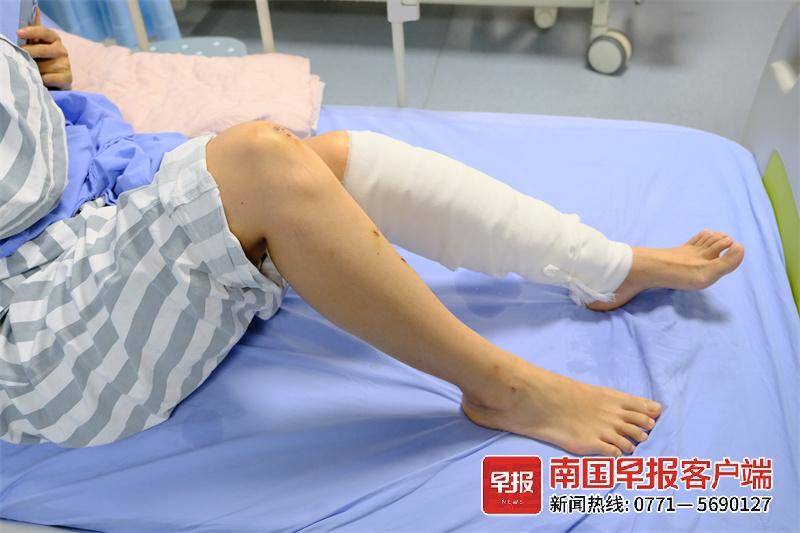6人登山游玩同时遭雷击户外遇雷电如何保命？