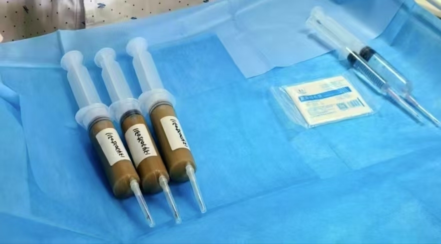 “便便”也能救人！男子被确诊“不死的癌症”，医生用粪菌移植治病
