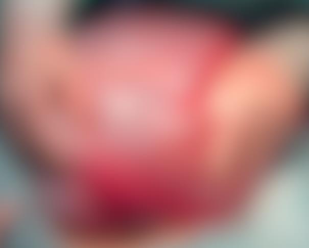相当于两个篮球！女子肚内藏“巨物”，医生：这病隐匿性强，很狡猾！