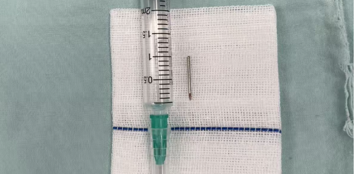 南宁12岁男孩用绣花针挑青春痘，针断脸里！医生提醒→