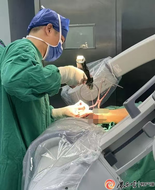 Kaiyun：3D打印技术“导航”40分钟微创手术搞掂严重粉碎性骨折(图1)